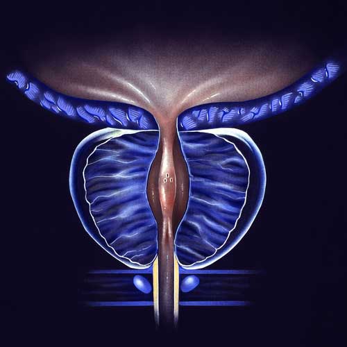 Cross-section illustration of a normal prostate and open urethra