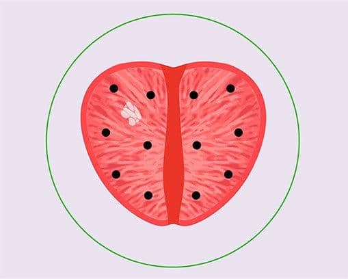 Illustration of prostate cross-section showing systematic biopsy cores and a suspicious lesion