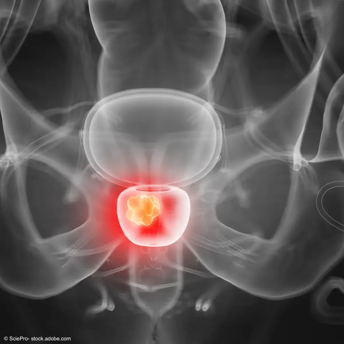 Scientific illustration representing PSMA PET imaging for prostate cancer
